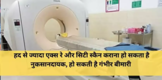 हद से ज्यादा एक्स रे और सिटी स्कैन कराना हो सकता है नुकसानदायक, हो सकती है गंभीर बीमारी