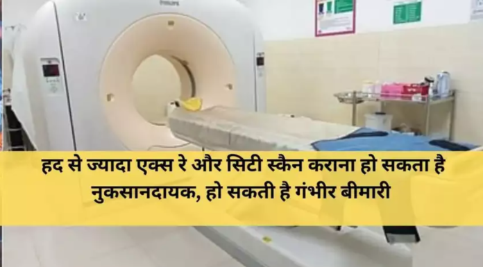 हद से ज्यादा एक्स रे और सिटी स्कैन कराना हो सकता है नुकसानदायक, हो सकती है गंभीर बीमारी