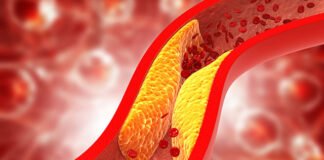 कोलेस्ट्रॉल को कम करने में सस्ती और कारगर होगी ये नई वैक्सीन