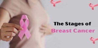 एस्ट्राजेनेका फार्मा इंडिया जनवरी में ब्रेस्ट कैंसर की दवा लॉन्च करेगी