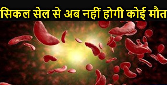 लाइलाज माने जाने वाले सिकल सेल की दवा तैयार, DGCI ने दी मंजूरी