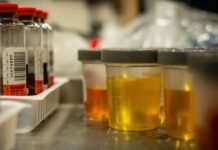 गुणवत्ता जांच में चार दवाइयां अमानक मिली, बिक्री पर रोक a-selection-of-urine-samples-ready-for-urinalysis