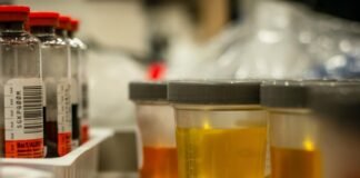 चार मेडिकल स्टोर पर रेड, गुणवत्ता खराब होने की आशंका में 12 दवाओं की बिक्री रोकी a-selection-of-urine-samples-ready-for-urinalysis