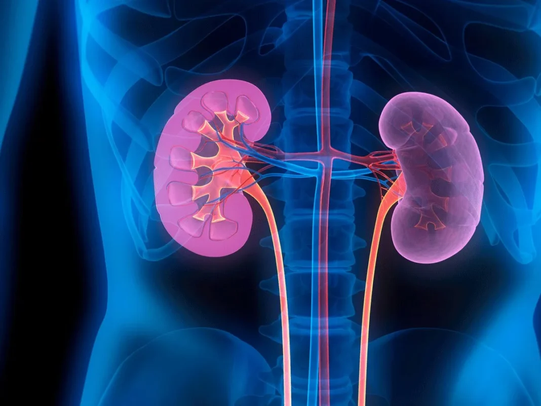 kidney-disease