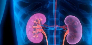 किडनी ट्रांसप्लांट मामले में एक और गिरफ्तार, पुलिस रिमांड पर भेजा kidney-disease