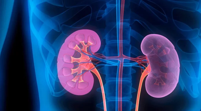 किडनी ट्रांसप्लांट मामले में एक और गिरफ्तार, पुलिस रिमांड पर भेजा kidney-disease