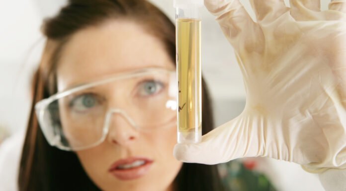 स्वास्थ्य विभाग ने मेडिकल स्टोरों से भरे दस दवाइयों के सैंपल sample