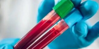 रोग जांच के रेट फिक्स किए, अब प्राइवेट हॉस्पिटल नहीं ले सकेंगेे मनमानी फीस