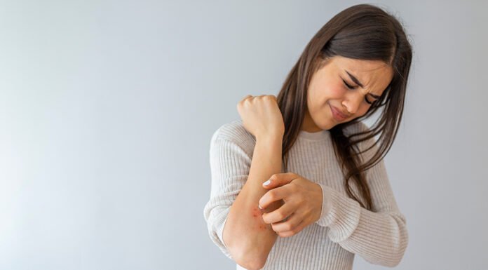 स्किन डिजीज की नकली दवा बनाने वाली फैक्ट्री का भंडाफोड़ 20211123-skin