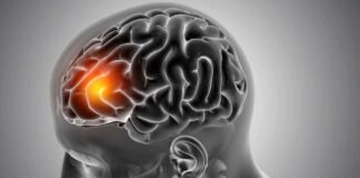 एचआईवी/एड्स की दवाओं का ब्रेन ट्यूमर के मरीजों पर परीक्षण