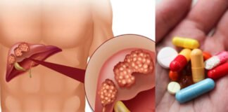 लीवर कैंसर से बचाने में सहायक है कोलेस्ट्रॉल की नई दवाएं