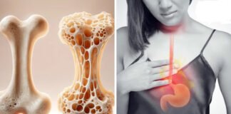 एसिडिटी की दवा दे रही ये साइड इफेक्ट, रहें अलर्ट