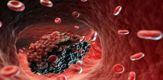 रक्त का थक्का रोकने में टेबलेट्स हैं ज्यादा असरदार