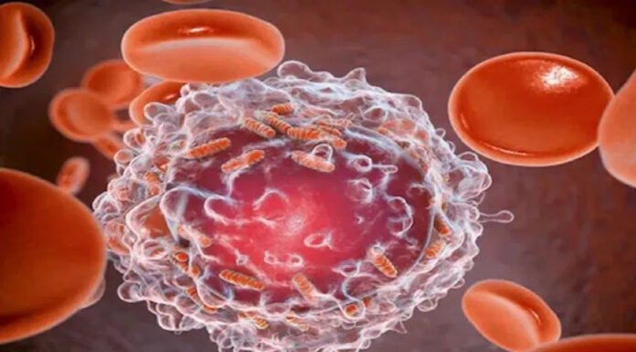 कैंसर का इलाज हुआ हाई-टेक, रोबोट करेगा ऑपरेशन