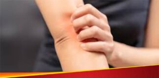 एफडीए ने एलर्जी की दवा को लेकर किया अलर्ट