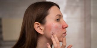 फ़ेयरनेस क्रीम के इस्तेमाल से हो सकता है भारी नुकसान
