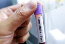 हीमोफीलिया रोधी दवा के इस्तेमाल पर लगाया प्रतिबंध