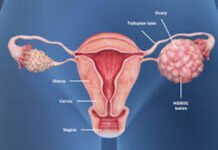 Ovarian Cancer के मरीजों के लिए नई दवा से बढ़ी उम्मीद