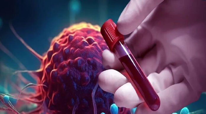 सेक्स पॉवर बढ़ाने वाली दवा वियाग्रा कैंसर में भी गुणकारी